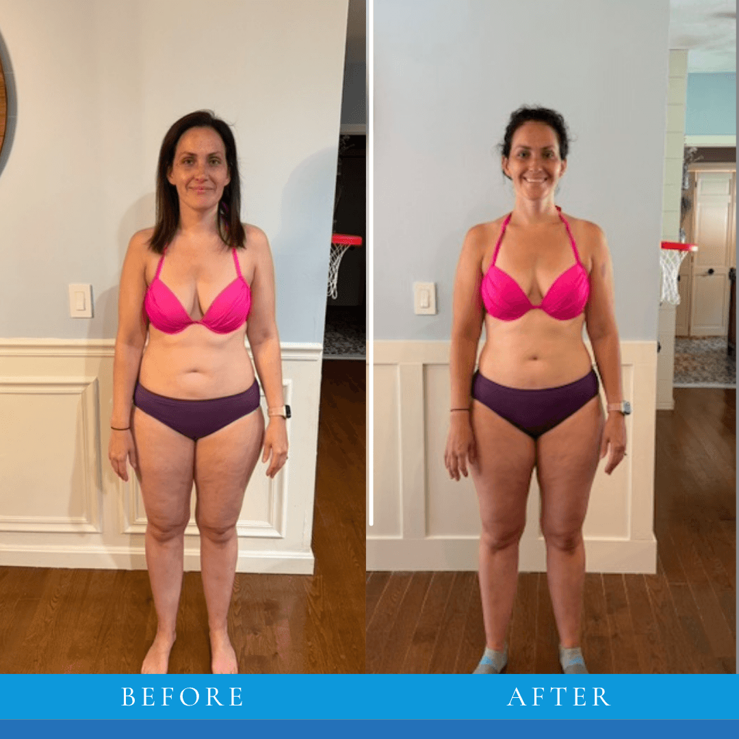 Erin transformation